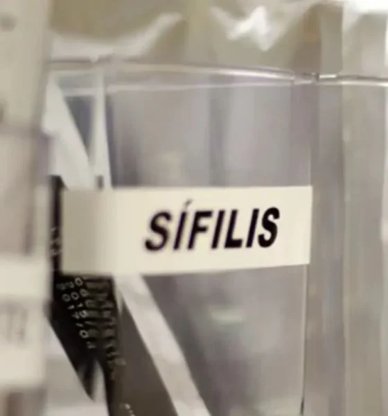 Sifilis