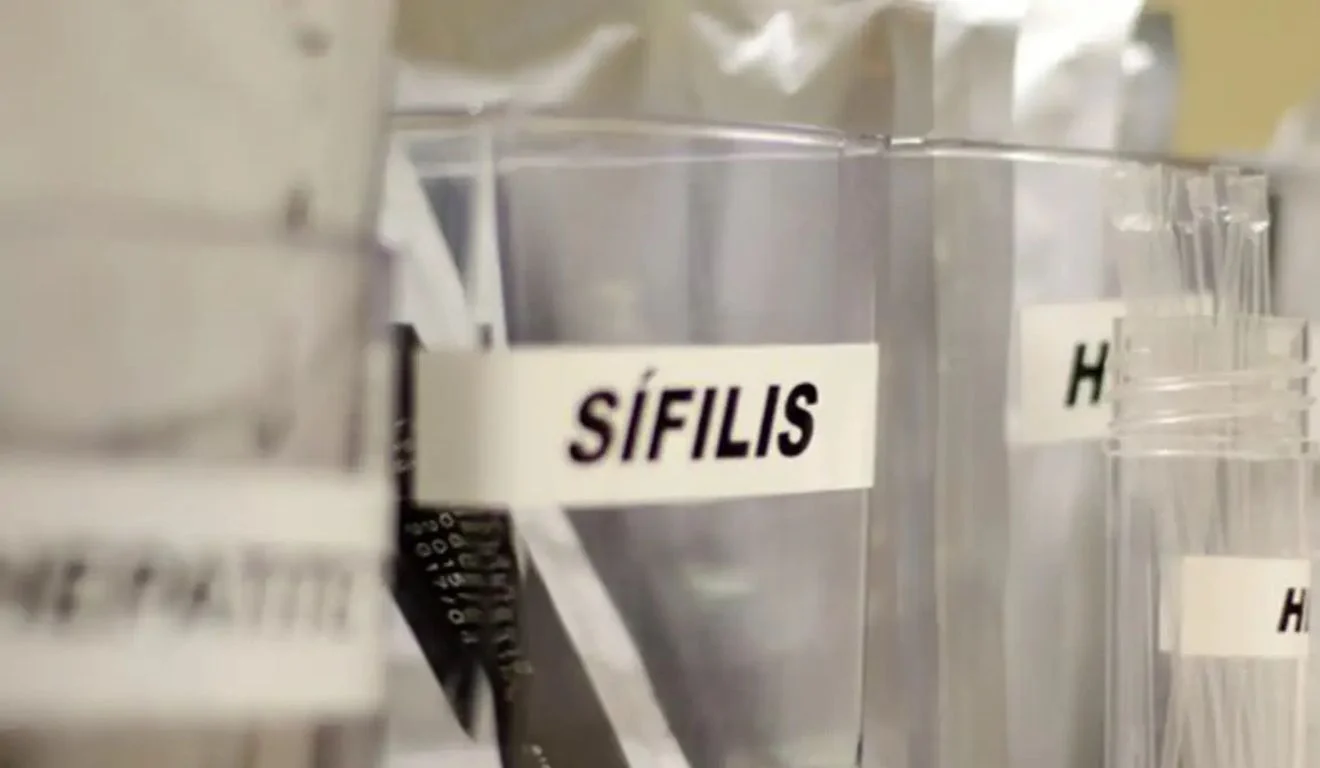 Sifilis